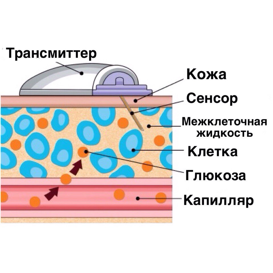 Принцип работы сенсора непрерывного мониторирования глюкозы